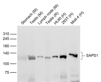 SAPS1 Rabbit Polyclonal Antibody