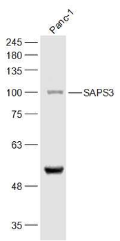 SAPS3 Rabbit Polyclonal Antibody