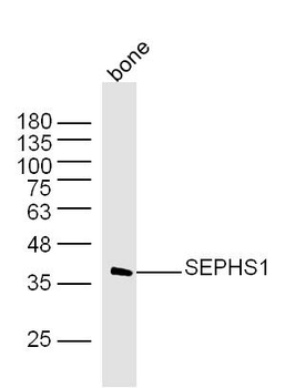 SEPHS1 Rabbit Polyclonal Antibody