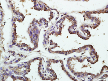SNRPE Rabbit Polyclonal Antibody