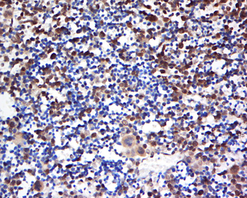 SNRPE Rabbit Polyclonal Antibody