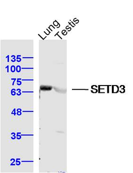 SETD3 Rabbit Polyclonal Antibody