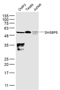 SH3BP5 Rabbit Polyclonal Antibody