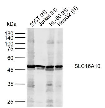 SLC16A10 Rabbit Polyclonal Antibody