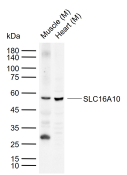 SLC16A10 Rabbit Polyclonal Antibody