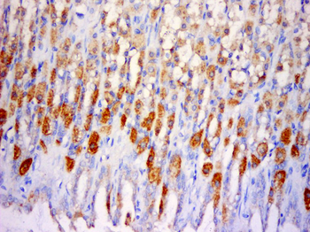 SLC25A38 Rabbit Polyclonal Antibody