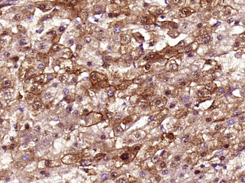 SLC26A3 Rabbit Polyclonal Antibody