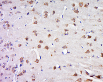 SLC32A1 Rabbit Polyclonal Antibody