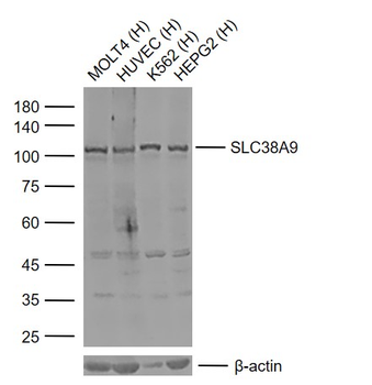 SLC38A9 Rabbit Polyclonal Antibody