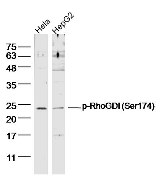 Phospho-RhoGDI (Ser174) Rabbit Polyclonal Antibody