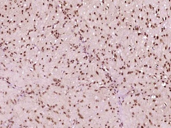 Src (phospho-Ser75) antibody