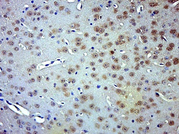 Smad3 (phospho-Thr179) antibody