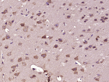 SMAD5 Rabbit Polyclonal Antibody