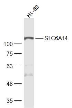 SLC6A14 Rabbit Polyclonal Antibody