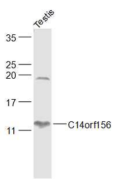 SLIRP/C14orf156 Rabbit Polyclonal Antibody