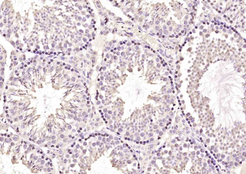 SLX4/BTBD12 Rabbit Polyclonal Antibody