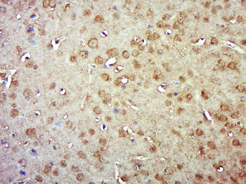 SMG1 Rabbit Polyclonal Antibody