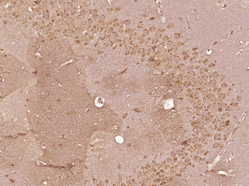 SMG5 Rabbit Polyclonal Antibody