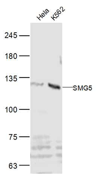 SMG5 Rabbit Polyclonal Antibody