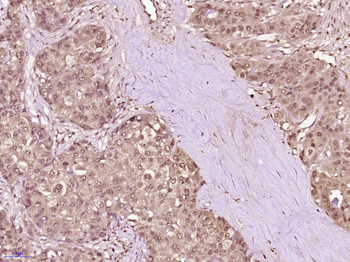 SMARCA5 Rabbit Polyclonal Antibody