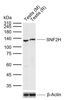 SMARCA5 Rabbit Polyclonal Antibody