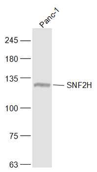 SMARCA5 Rabbit Polyclonal Antibody