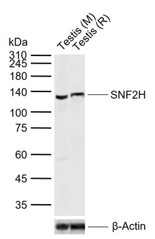 SNF2H antibody