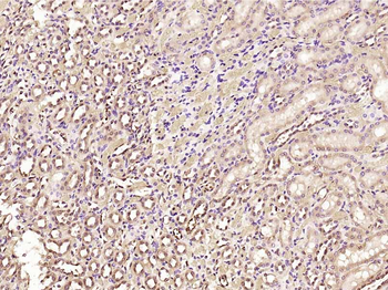 SNRNP200 Rabbit Polyclonal Antibody