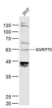 SNRP70 Rabbit Polyclonal Antibody