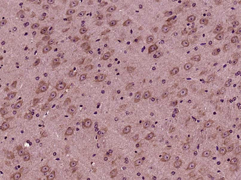 STCH/HSPA13 Rabbit Polyclonal Antibody