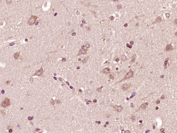 STK11IP Rabbit Polyclonal Antibody