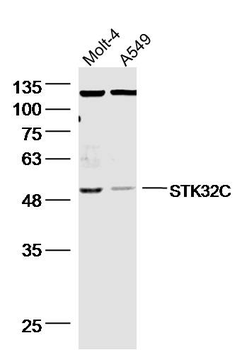 STK32C Rabbit Polyclonal Antibody