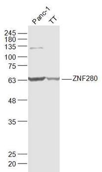 SUHW1/ZNF280 Rabbit Polyclonal Antibody