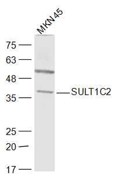 SULT1C2 Rabbit Polyclonal Antibody