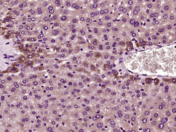Survivin 3 alpha Rabbit Polyclonal Antibody