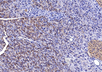 SLC26A6 Rabbit Polyclonal Antibody