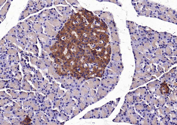 SLC26A6 Rabbit Polyclonal Antibody