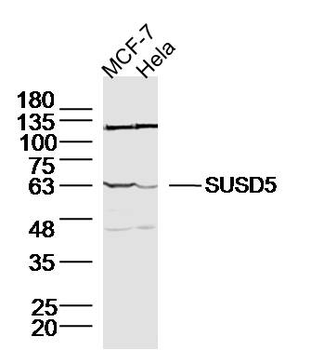 SUSD5 Rabbit Polyclonal Antibody