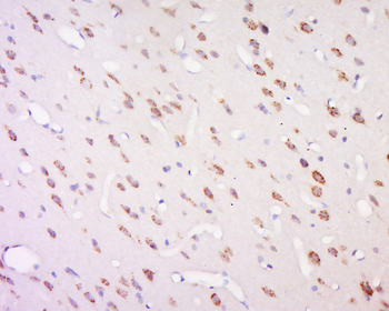 SCN1A Rabbit Polyclonal Antibody
