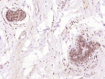 STAT2 Rabbit Polyclonal Antibody
