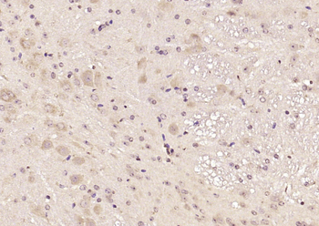 TREM2 Rabbit Polyclonal Antibody
