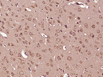 Tyrosine Hydroxylase Rabbit Polyclonal Antibody