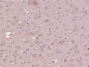 Tyrosine Hydroxylase Rabbit Polyclonal Antibody