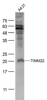TIMM22 Rabbit Polyclonal Antibody