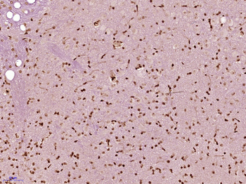 TINP1/NSA2 Rabbit Polyclonal Antibody