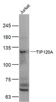 TIP120A Rabbit Polyclonal Antibody