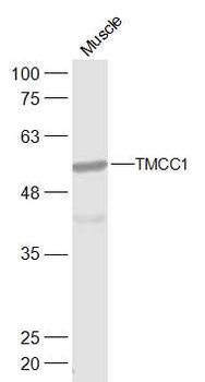 TMCC1 Rabbit Polyclonal Antibody