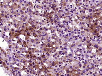 TMEM109 Rabbit Polyclonal Antibody