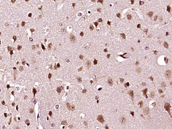 TMEM109 Rabbit Polyclonal Antibody