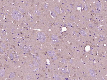 TMEM132D Rabbit Polyclonal Antibody